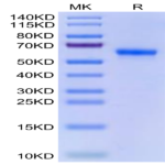 Human ULBP-2 Protein (ULB-HM202)