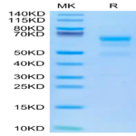 Human ULBP-4 Protein (ULB-HM204)