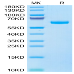 Human ULBP-6 Protein (ULB-HM206)