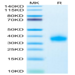 Human ULBP-2 Protein (ULB-HM402)