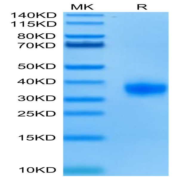 Biotinylated Human ULBP-2 Protein (ULB-HM402B)