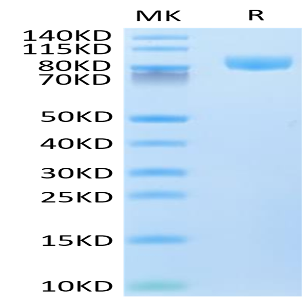 Human VCAM-1/CD106 Protein (VAM-HM106)