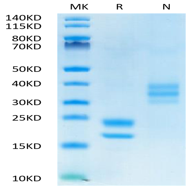 Human VEGF121 Protein (VEG-HM421)