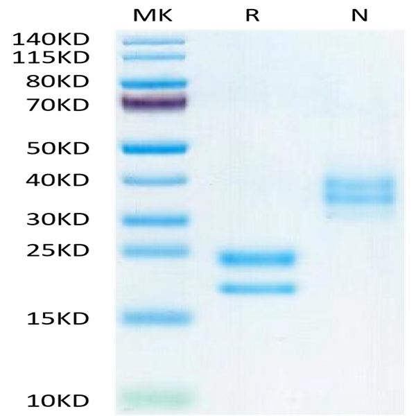 Biotinylated Human VEGF121 Protein (VEG-HM421B)