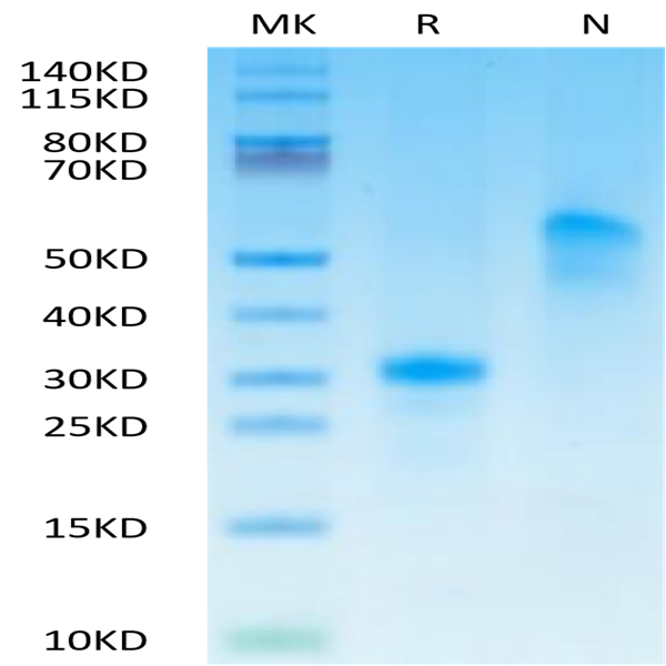 Human VEGF165 Protein (VEG-HM465)