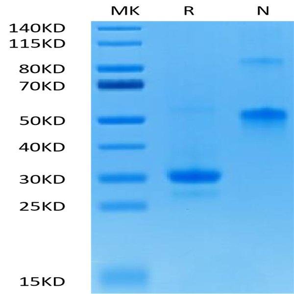 Biotinylated Human VEGF165 Protein (VEG-HM465B)