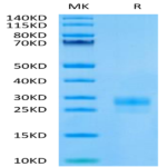 Human VEGF-C/Flt4-L Protein (VEG-HM4F1)