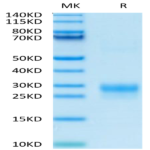 Biotinylated Human VEGF-C/Flt4-L Protein (VEG-HM4F1B)