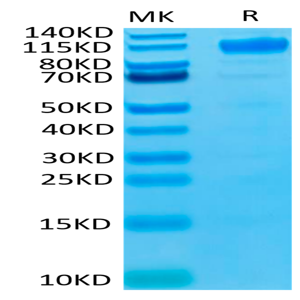 Biotinylated Human VEGF R1/FLT-1 Protein (VGF-HM4R1B)