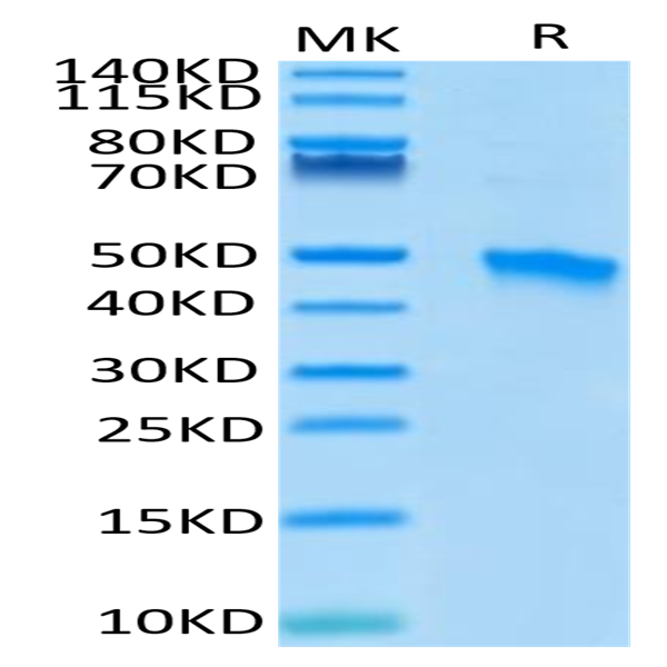 Human VSIG4 Protein (VSG-HM104)