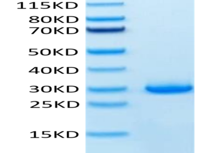 Human VSIG8 Protein (VSG-HM108)