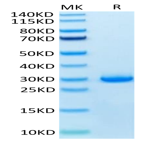 Human VSIG8 Protein (VSG-HM108) Human VSIG8 Protein (VSG-HM108)