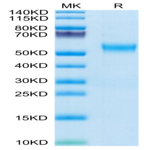 Human VSTM5 Protein (VSM-HM205)