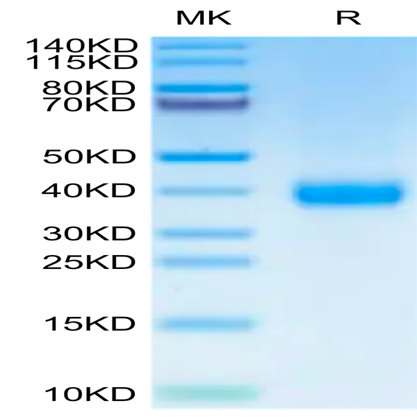 SARS-CoV-2 Spike RBD (Omicron XBB) Protein (XBB-HM1BD)