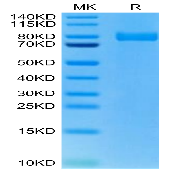 Rat XPNPEP2 Protein (XPP-RM101)
