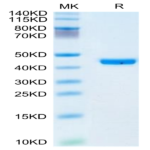 Human YKL-40/CHI3L1 Protein (YKL-HM140)