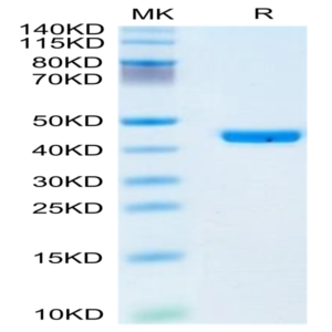 Human YKL-40/CHI3L1 Protein (YKL-HM140)